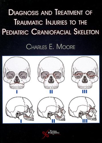 Craniofacial-Injuries
