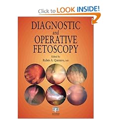 Diagnostic and Operative Fetoscopy by Rubén A. Quintero