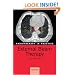 Radiotherapy in Practice - External Beam Therapy
