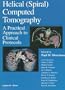 Helical (Spiral) Computed Tomography: A Practical Approach to Clinical Protocols