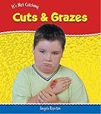 Cuts & grazes