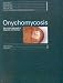 Book Onychomycosis: the current approach to diagnosis and therapy