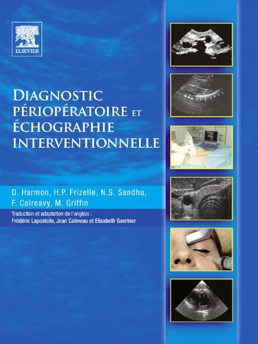 Diagnostic périopératoire et échographie interventionnelle: avec DVD en anglais (French Edition)