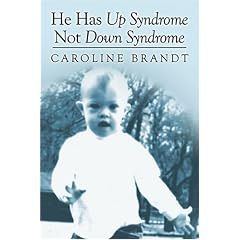 He Has Up Syndrome Not Down Syndrome