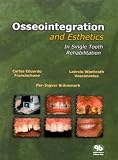 Osseointegration And Esthetics In Single Tooth Rehabilitation