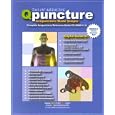Q-Puncture Acupuncture made simple by  Hansen, M.D. Lee and Yeung Kwon