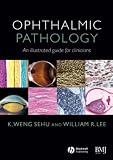 Ophthalmic Pathology: An Illustrated Guide for Clinicians