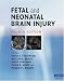 Books : Fetal and Neonatal Brain Injury