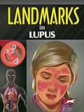 Landmarks in Lupus