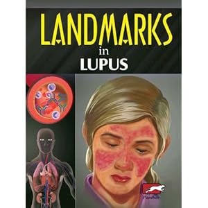 Landmarks in Lupus