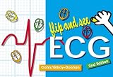 Flip and See ECG