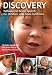 Discovery: Pathways to Better Speech for Children With Down Syndrome Image