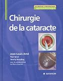 Chirurgie de la cataracte