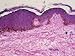 Photomicroscopy, Skin X.S. Epidermal Layer Photographic Poster Print, 16x12