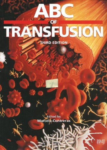 ABC of Transfusion (ABC Series)