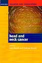 Palliative care consultations in head and neck cancer