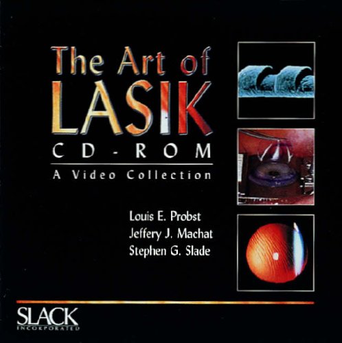LASIK