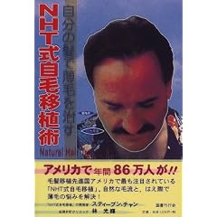 NHT式自毛移植術―自分の髪で薄毛を治す