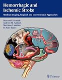 Hemorrhagic and Ischemic Stroke: Medical, Imaging, Surgical and Interventional  Approaches