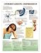 Chart - Understanding Depression