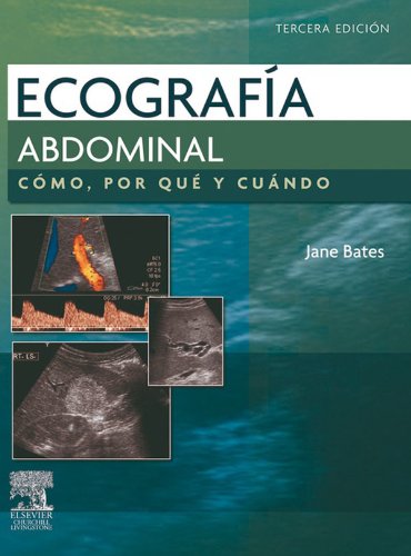 Ecografía abdominal. Cómo, por qué y cuándo (Spanish Edition)