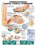 Understanding Carpal Tunnel Syndrome Anatomical Chart