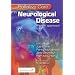 Palliative Care in Neurological Disease: A Team Approach