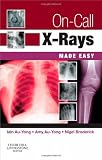 On-Call X-Rays Made Easy, 1e