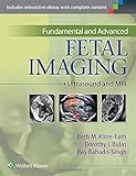 Fundamental and Advanced Fetal Imaging: Ultrasound and MRI