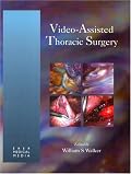 Video Assisted Thoracic Surgery