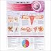 Infertility Anatomical Chart