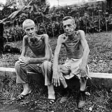 Emaciated Americans, Lee Rogers and John Todd, Japan Prison Camp Following Release by Allied Forces Art Photographic Poster Print by Carl Mydans, 24x24