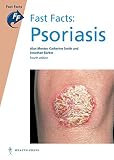 Fast facts. Psoriasis