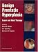 Book Benign Prostatic Hyperplasia: Laser and Heat Therapies