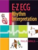 E-Z ECG Rhythm Interpretation