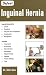 Defeat Inguinal Hernia
