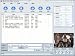 Xilisoft Microsoft Zune DVD & Video Converter Suite
