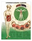 Understanding Cancer Anatomical Chart Laminated-9756PL1.5