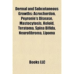 Dermal and subcutaneous growths: Acrochordon, Peyronie's disease, Mastocytosis, Keloid,... by Source: Wikipedia