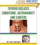 Thyroid Diseases, Conditions, Autoimmunity and Cancers