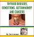 Thyroid Diseases, Conditions, Autoimmunity and Cancers