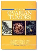 Atlas of Ovarian Tumors