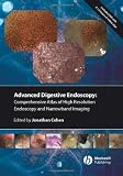 Comprehensive Atlas of High Resolution Endoscopy and Narrowband Imaging