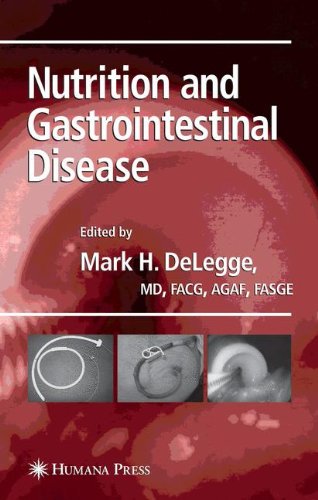 Nutrition and Gastrointestinal Disease (Clinical Gastroenterology)