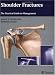 Shoulder Fractures: The Practical Guide to Management