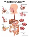 Gastroesophageal Disorders Anatomical Chart