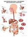 Gastroesophageal Disorders Anatomical Chart