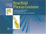 Brachial Plexus Lesions: Drawings of Explorations and Reconstructions