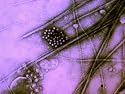 Astrovirus from Stool Diarrhea Virus Intestinal Photographic Poster Print, 24x18