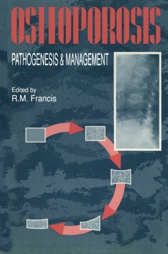 Osteoporosis: Pathogenesis and Management